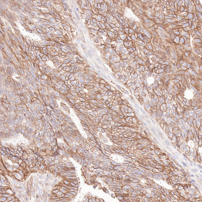 Beta 2 microglobulin Recombinant rabbit mAb (SDT-096-100)