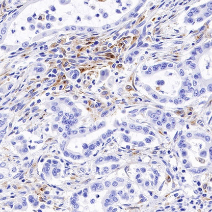 GPNMB Recombinant Rabbit mAb (S-491-6)
