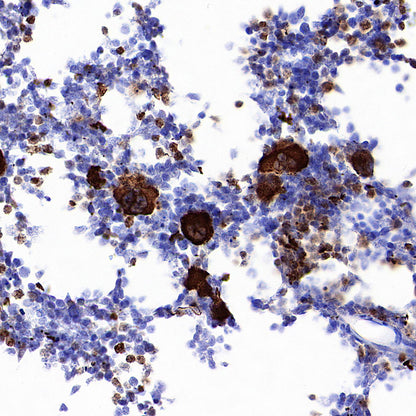Thrombospondin 1 Recombinant Rabbit mAb (S-4153-22)