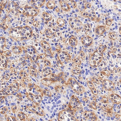 UBASH3B/Sts1 Recombinant Rabbit mAb (S-1307-5)