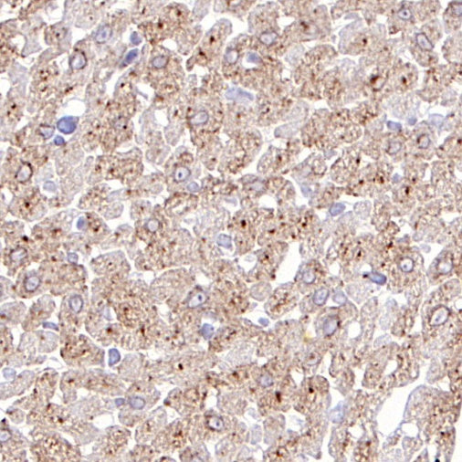 GLUT4 Recombinant Rabbit mAb (S-584-50)