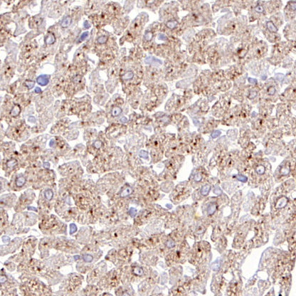 GLUT4 Recombinant Rabbit mAb (S-584-50)
