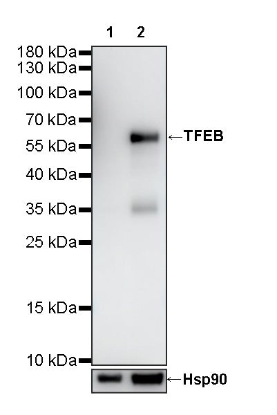 TFEB Recombinant Rabbit mAb (S-R296)
