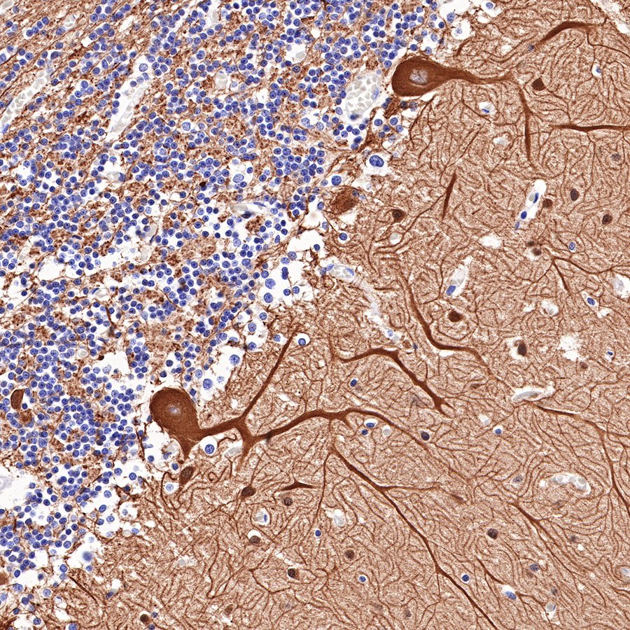 Beta III tubulin Recombinant Rabbit mAb (SDT-251-28)