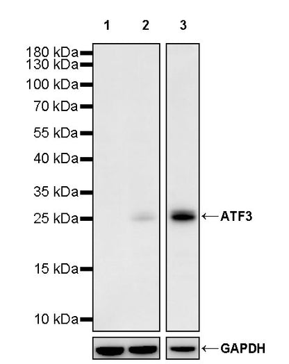 ATF3 Recombinant Rabbit mAb (S-3904)