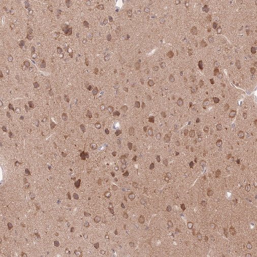 SQSTM1/p62 Recombinant Rabbit mAb (S-778-1)