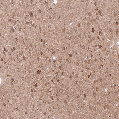 SQSTM1/p62 Recombinant Rabbit mAb (S-778-1)