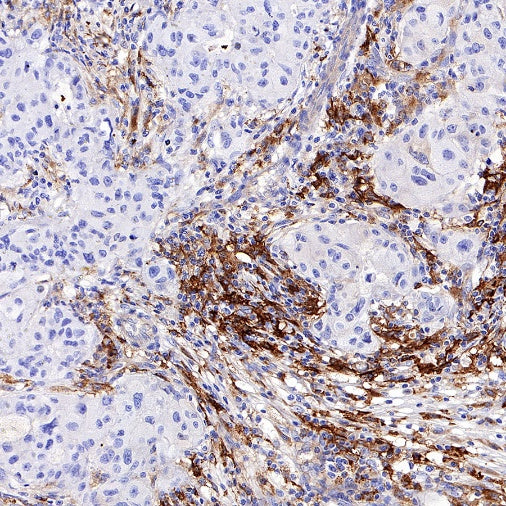 HLA-DRB1 Recombinant Rabbit mAb (SDT-R253)