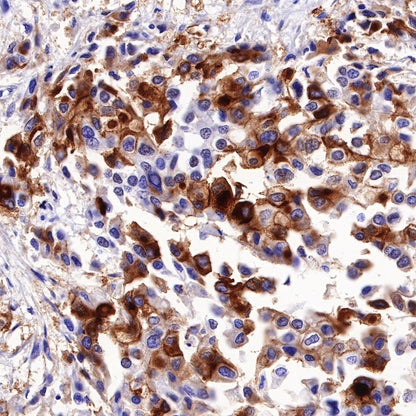 Uroplakin III Recombinant Rabbit mAb (SDT-R177)