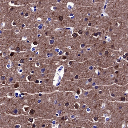 PSD-95 Recombinant Rabbit mAb (S-1518-4)