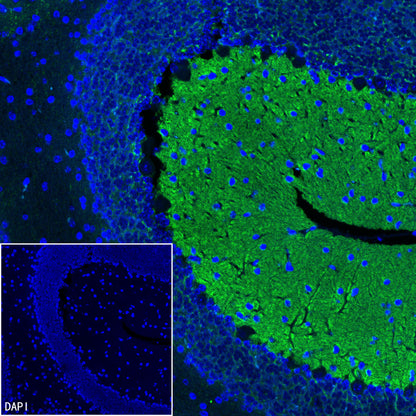pan SCN Recombinant Rabbit mAb (S-5038)