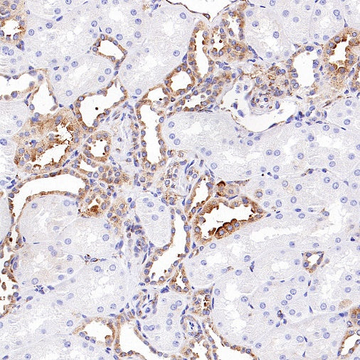 M6PR Recombinant Rabbit mAb (S-2348-14)