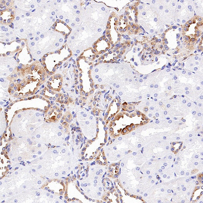 M6PR Recombinant Rabbit mAb (S-2348-14)