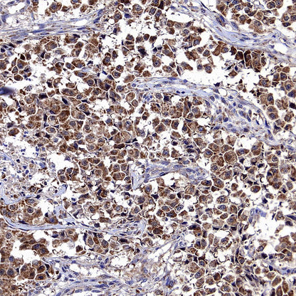 USP14 Recombinant Rabbit mAb (S-4022-13)