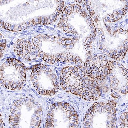 ALCAM Recombinant Rabbit mAb (S-4080-21)