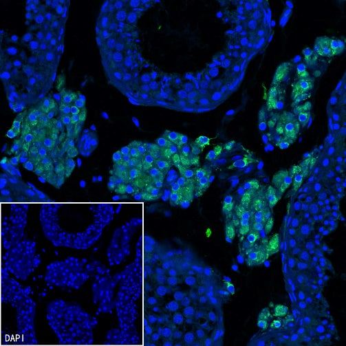 CYP11A1 Rabbit Polyclonal Antibody