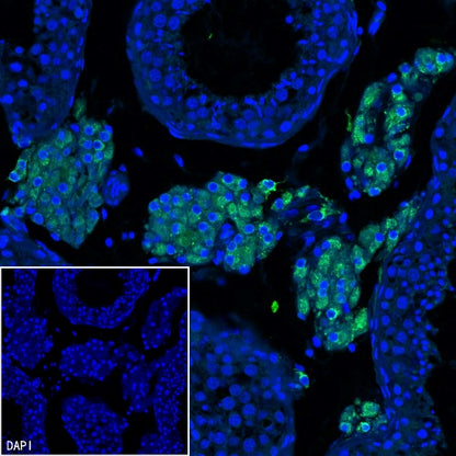 CYP11A1 Rabbit Polyclonal Antibody