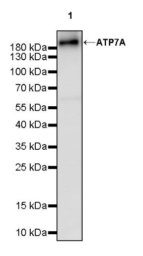 ATP7A Recombinant Rabbit mAb (S-2289-106)
