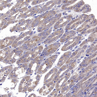 ADRB2 Recombinant Rabbit mAb (S-2418-144)