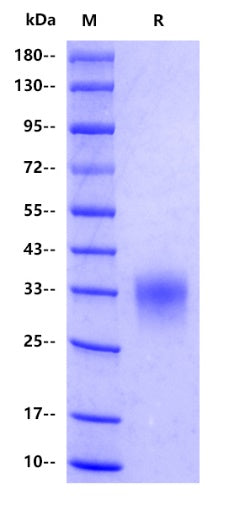 Mouse CD8A Protein, His tag