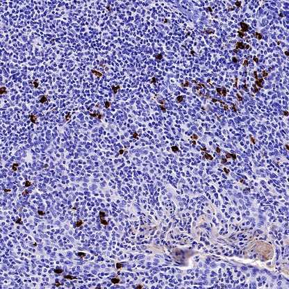 Human IgA1 Recombinant Rabbit mAb (S-2513-50)