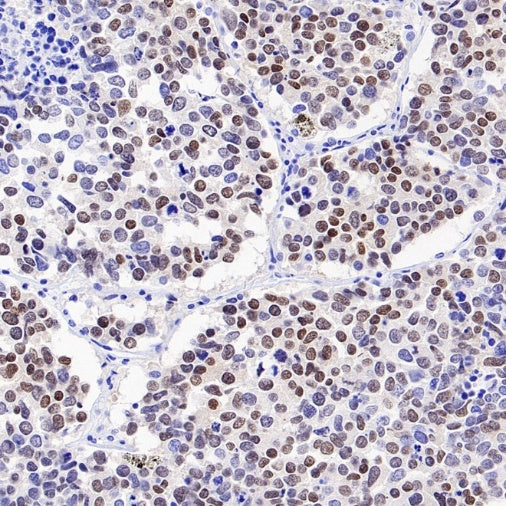 ASCL1/MASH1 Recombinant Rabbit mAb (SDT-3517-121)