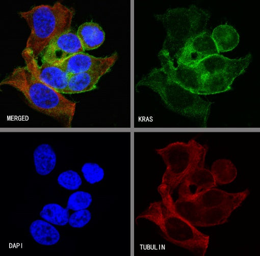 KRAS Recombinant Rabbit mAb (S-R291)