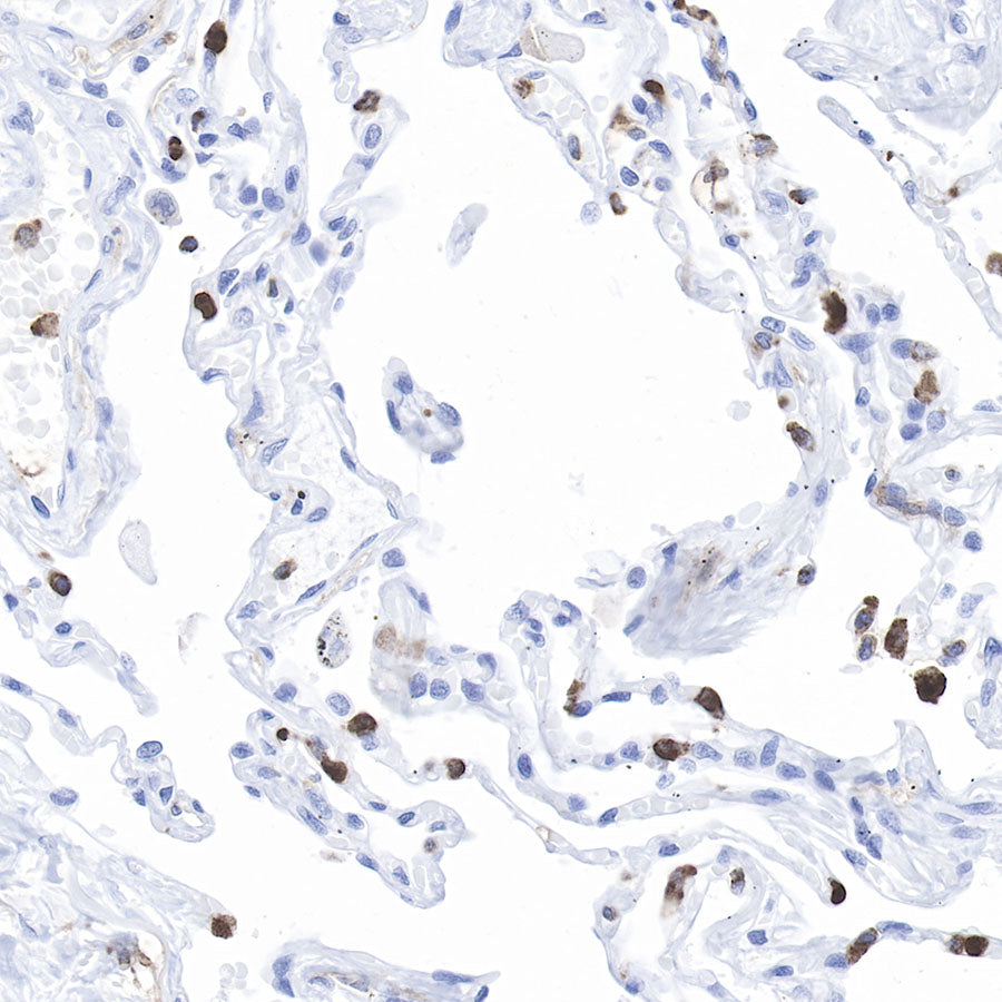 CD11b Recombinant Rabbit mAb,PBS Only (SDT-058-44)