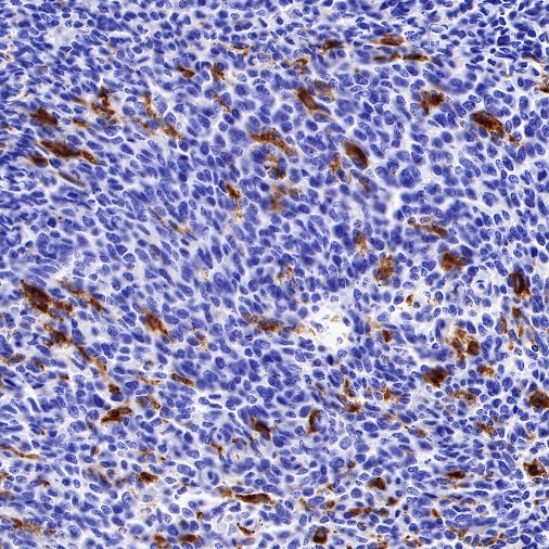 GPNMB Recombinant Rabbit mAb (S-491-6)