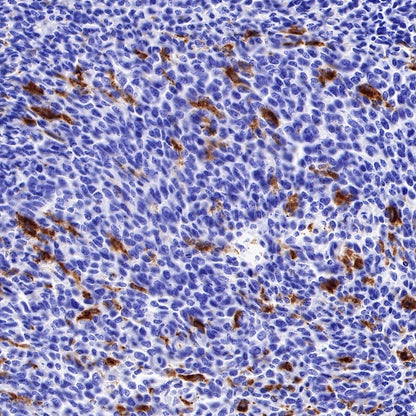 GPNMB Recombinant Rabbit mAb (S-491-6)
