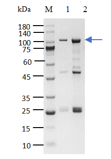 BTK[T316A] Protein