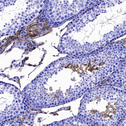 Angiotensin Converting Enzyme 1 Recombinant Rabbit mAb (SDT-2662-122)
