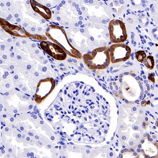 ACSL4/FACL4 Recombinant Rabbit mAb (S-461-6)