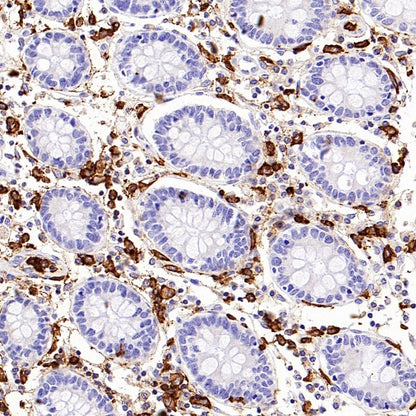 NOX2/gp91phox Recombinant Rabbit mAb (S-2974-75)