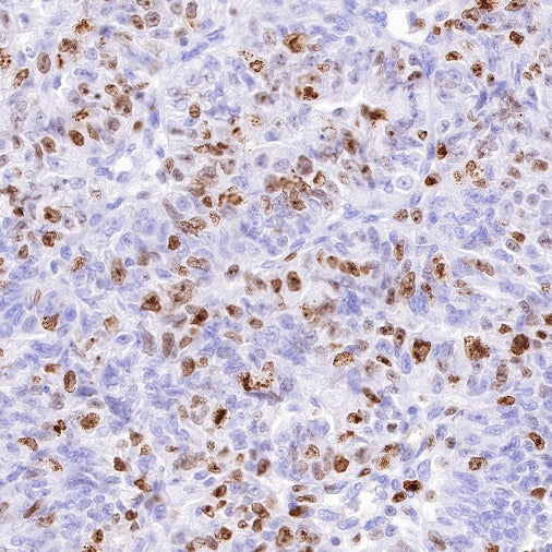 Ki67 Mouse mAb (SDT-606-33)