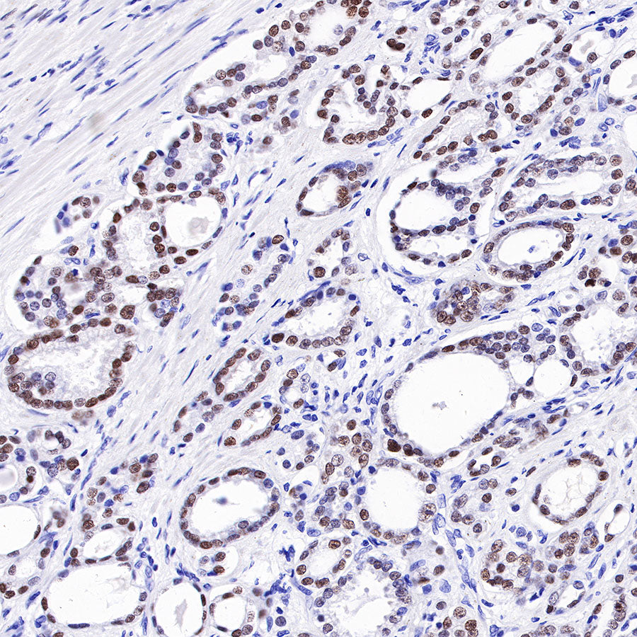 Androgen Receptor Recombinant Rabbit mAb (SDT-R157)