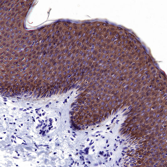 Keratin 10 Recombinant Rabbit mAb (SDT-124-6)