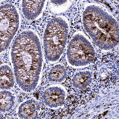 Lipocalin-2/NGAL Recombinant Rabbit mAb (S-2279-72)