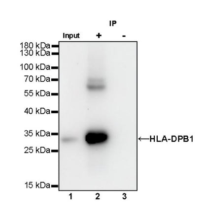 HLA-DPB1 Recombinant Rabbit mAb (S-R263)