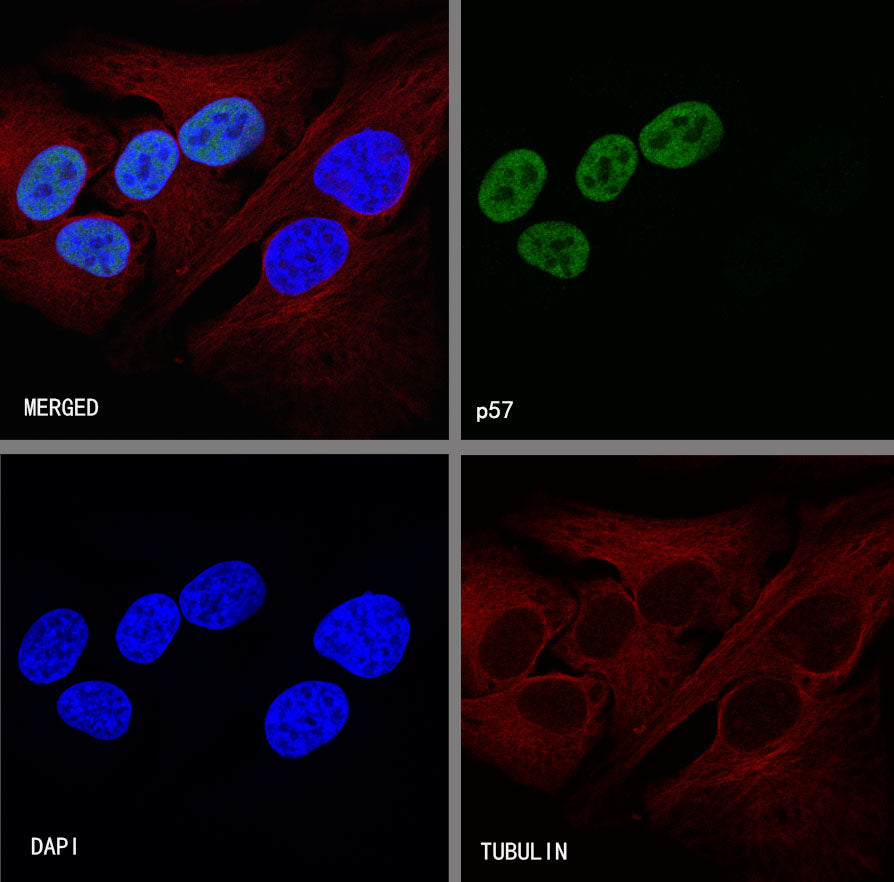 p57 Recombinant Rabbit mAb (SDT-191-79)