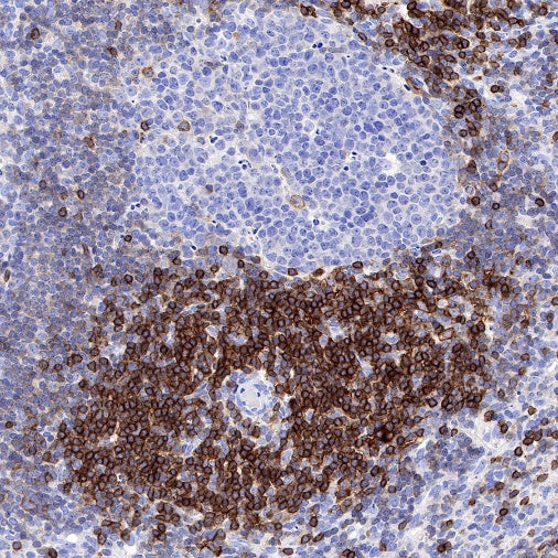 CCR7 Recombinant Rabbit mAb (S-999-29)