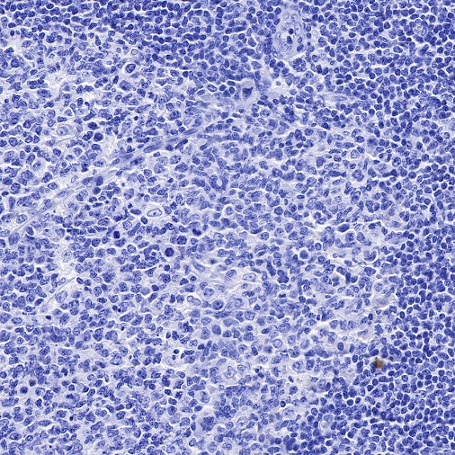 S-RMab® Cadherin 17 Recombinant Rabbit mAb (SDT-736-23)
