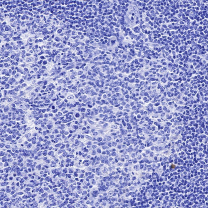 S-RMab® Cadherin 17 Recombinant Rabbit mAb (SDT-736-23)