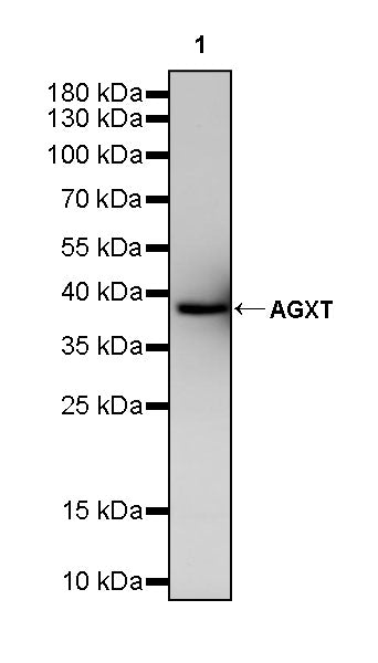 AGXT Recombinant Rabbit mAb (S-3586-30)