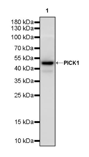 PICK1 Recombinant Rabbit mAb (S-2346-165)