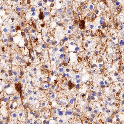 Glutamine Synthetase (GS) Recombinant Rabbit mAb (SDT-549-25)