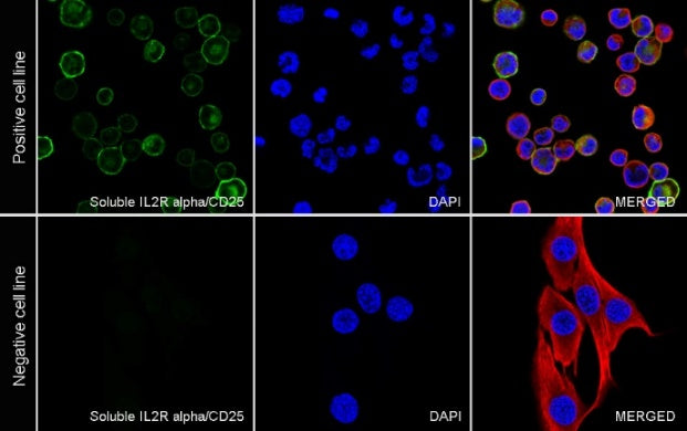 CD25/IL-2Rα Recombinant Rabbit mAb (SDT-2234-65)