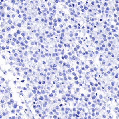 NY-ESO-1 Recombinant Rabbit mAb (SDT-R154)