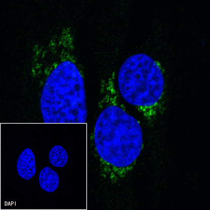 Inhibin alpha Recombinant Rabbit mAb (SDT-R307)