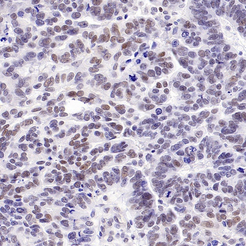 CDK6 Recombinant Rabbit mAb (S-1312-23)